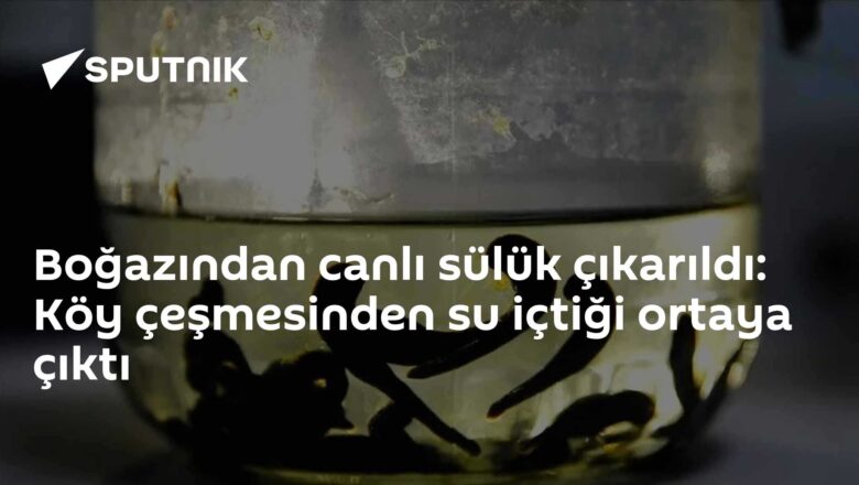 canlı sülük